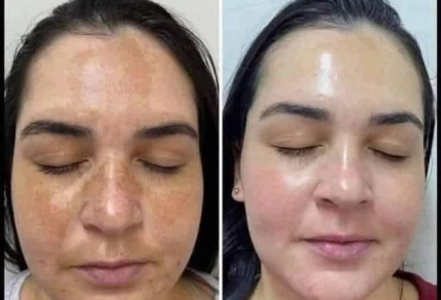 Before / After